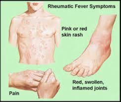 Ảnh 2 của Rheumatic fever